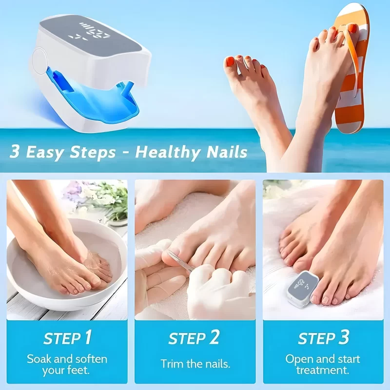 Traitement des champignons à ongles Dispositif laser LED pour nettoyer Onychomycosis Charge USB 905nm Lumière infrarouge 470nm Lumière bleue Salon à ongles – Image 5