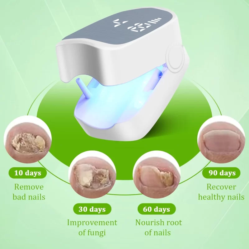 Traitement des champignons à ongles Dispositif laser LED pour nettoyer Onychomycosis Charge USB 905nm Lumière infrarouge 470nm Lumière bleue Salon à ongles