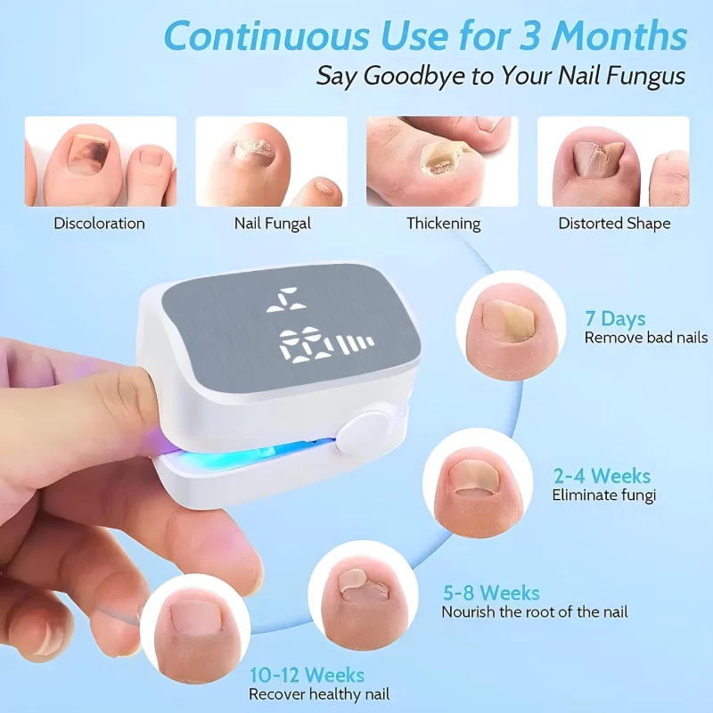 Traitement des champignons à ongles Dispositif laser LED pour nettoyer Onychomycosis Charge USB 905nm Lumière infrarouge 470nm Lumière bleue Salon à ongles – Image 6