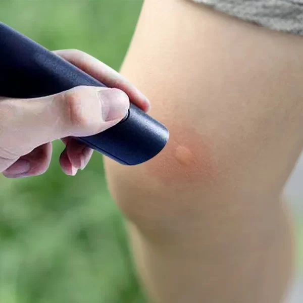 Stylo électronique anti-piqûre de moustique, soulagement de la douleur brûlante et du gonflement, soulage les piqûres, outil Portable pour l'été – Image 5