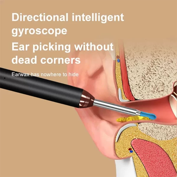 Tinsol-Nettoyeur d'oreille visuel intelligent, Kanoscope, Endoscope de charge USB C, Outil de suppression d'avertissement, Appareil photo Earpick, Soins de santé, Bâtons d'oreille, 1296P – Image 3